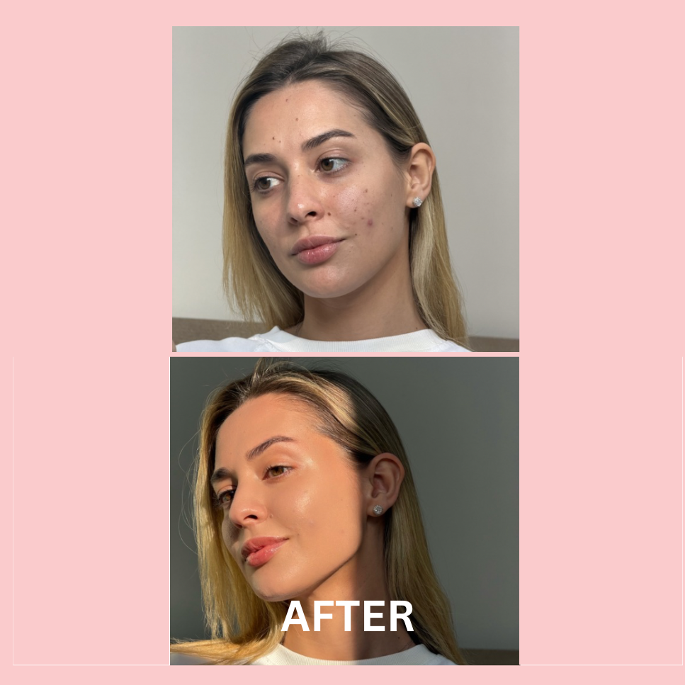 Glow Foundation- Light on skin- Heavy on glow.